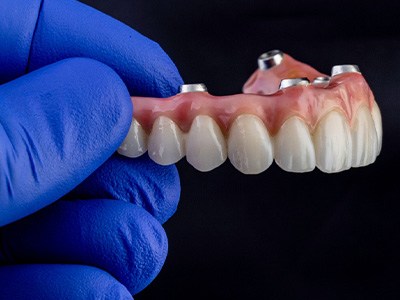 A gloved hand holding an implant denture