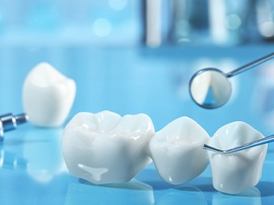 Dental implant and dental bridge parts next to dental tools