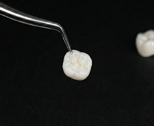A closeup of a ceramic dental crown held by tweezers