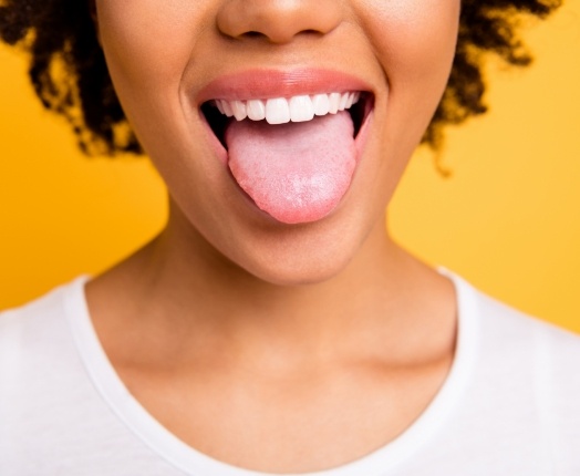 Person sticking out tongue after hairy tongue treatment