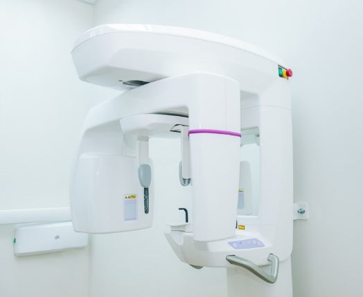 Panorex 3 D C T digital x-ray scanner