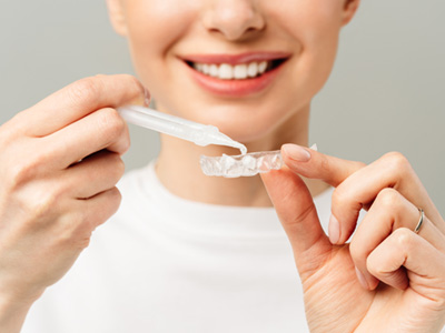 : A young woman preparing bleaching gel for her teeth whitening tray