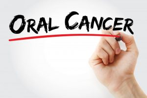 an oral cancer sign
