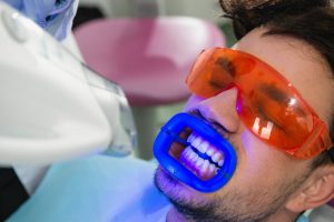 teeth whitening by dentist in Temple