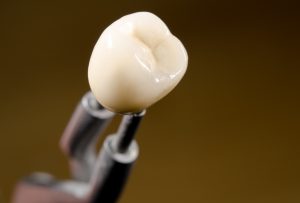 Dental crown at dentist in Temple