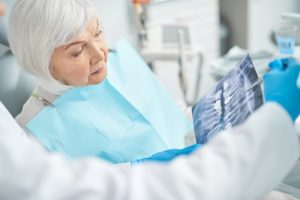 concerned patient talking to dentist