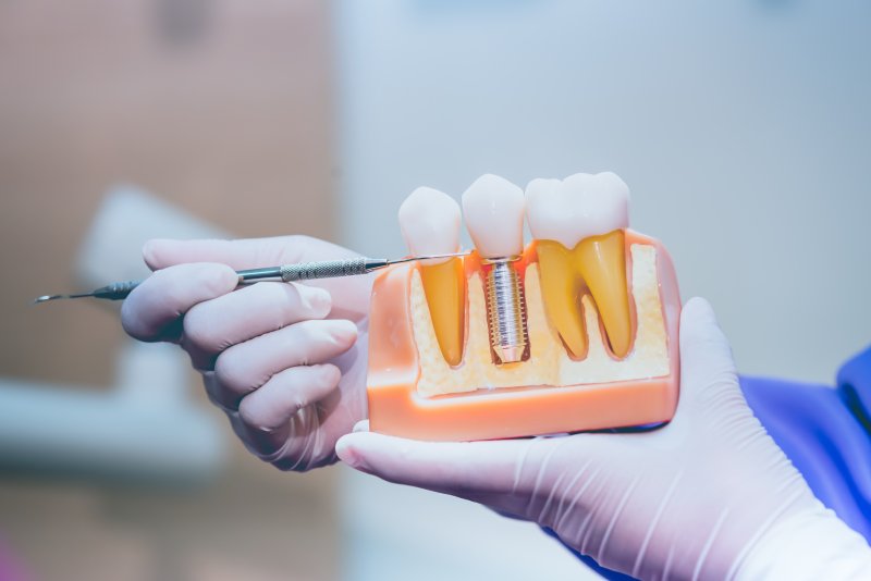 dentist explaining dental implant success in Temple