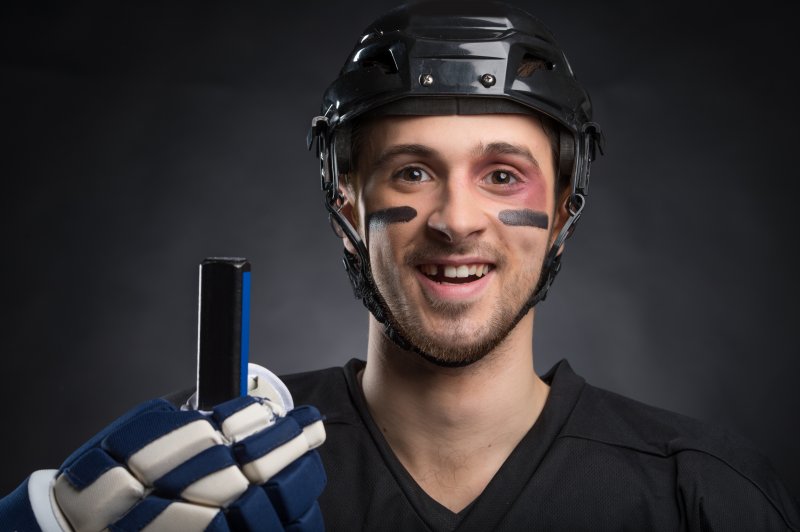 A funny and injured hockey player with a missing tooth